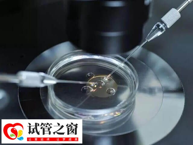 试管移植是一种辅助生育技术