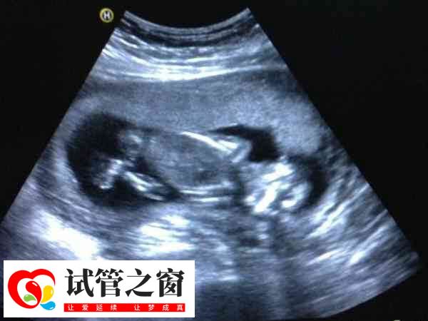 试管打夜针是一种促进排卵的方式