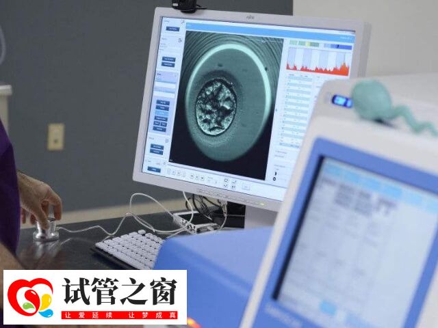 试管婴儿成功率因人而异