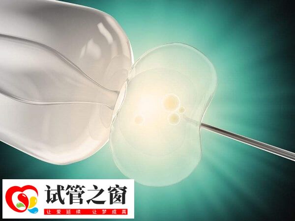 试管婴儿移植是一个复杂的过程
