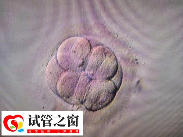 唐都医院二次移植费用多少取决于是否有冻胚