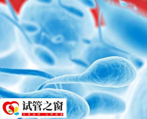 DFI是评估精子质量和生育能力的关键参数