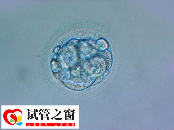 试管移植后会出现一些症状表现
