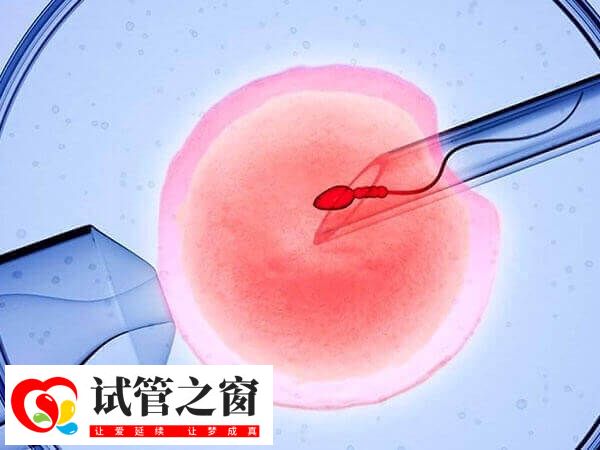 第四代试管技术研究方向