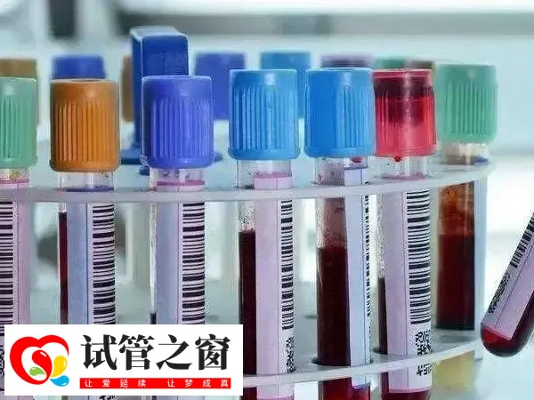 做试管检查性激素六项很有必要