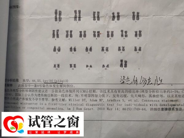 9号染色体是人类的23对染色体之一