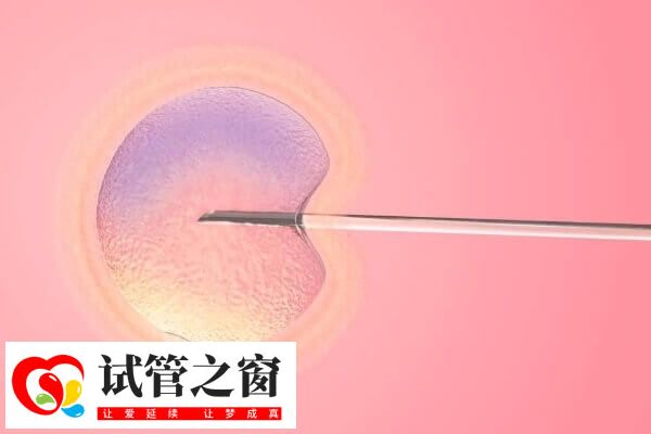 柬埔寨试管成功率很高