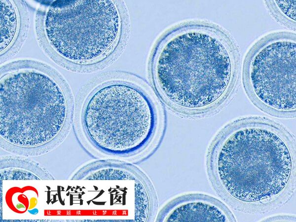 拮抗剂方案的移植时间因移植类型不同而有所差异