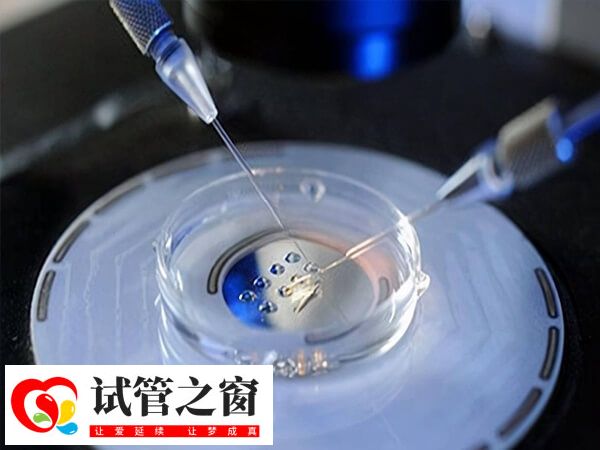 试管方案和试管移植的过程是不一样的