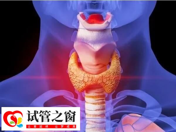 甲减是由于甲状腺激素分泌不足引起疾病
