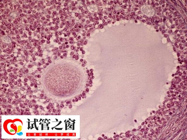 试管婴儿也称为体外受精-胚胎移植