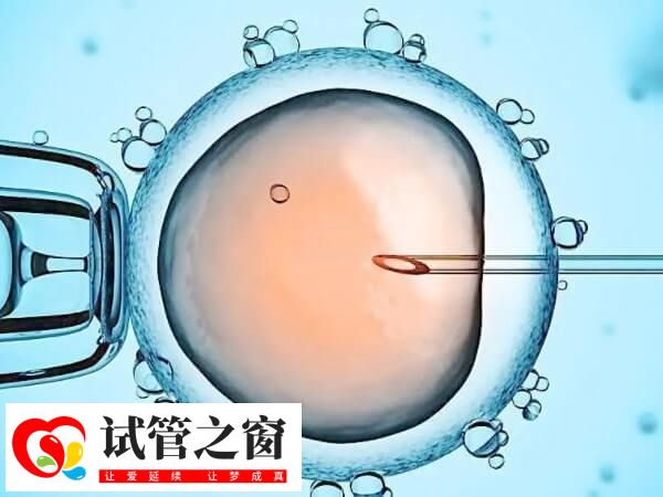 系统性红斑狼疮能做试管婴儿