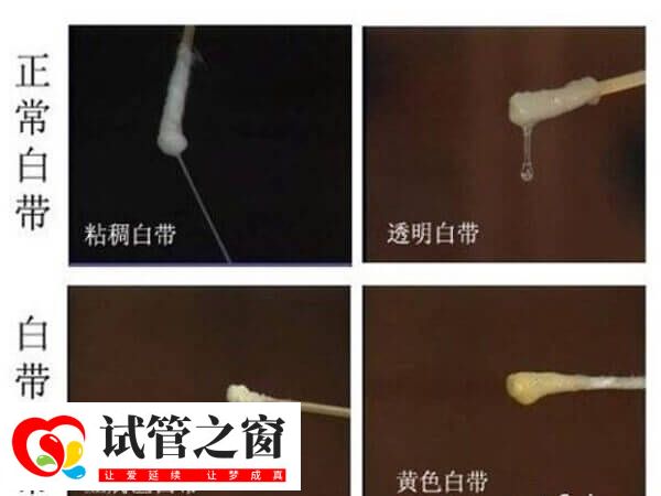 着床成功正常白带图片
