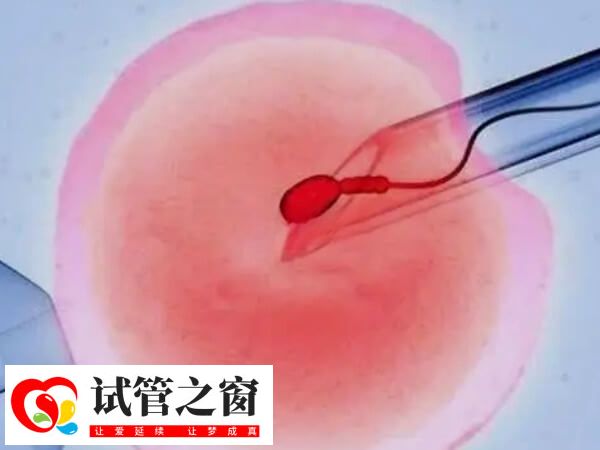 单腔取卵针只有一个细长的管道