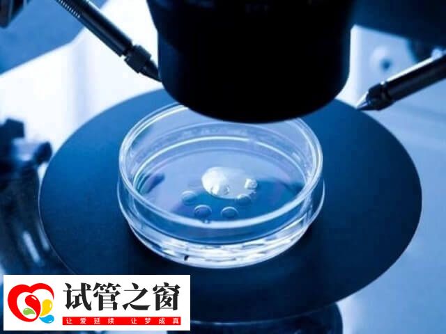 试管婴儿为什么会出现畸形(图1) 染色体会引起胚胎发育缺陷