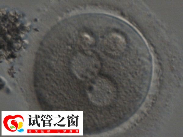 试管一代转二代会不会浪费卵子(图1) 一代转二代是基于现有卵子的补救措施