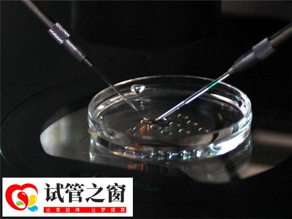 高龄适合做第三代试管婴儿