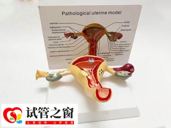 始基子宫是先天性发育不良