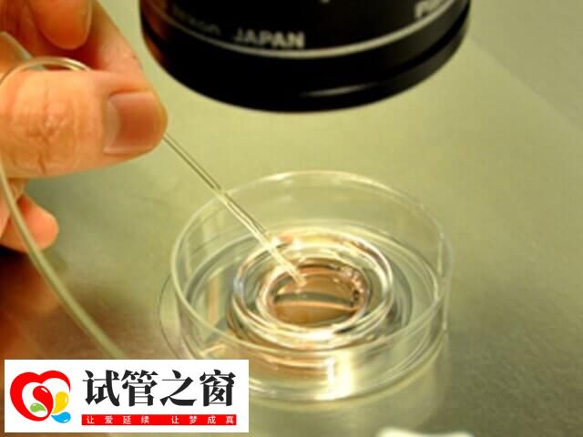 试管受精卵需培养3到5天成为胚胎