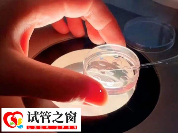 胚胎移植后不要一直卧床