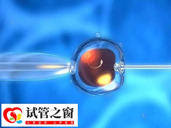 做试管婴儿需要建档
