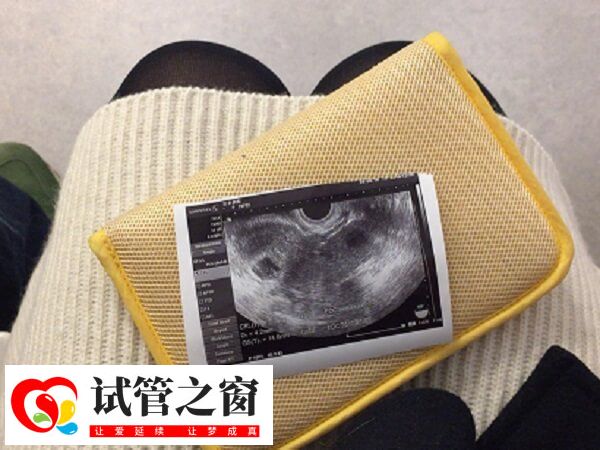 怀孕第6周发育指南(图1) 怀孕六周的时候胚胎发育很迅速了