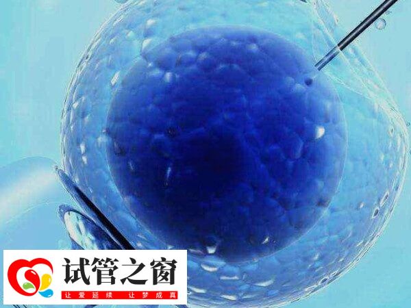 试管术前检查可以同房