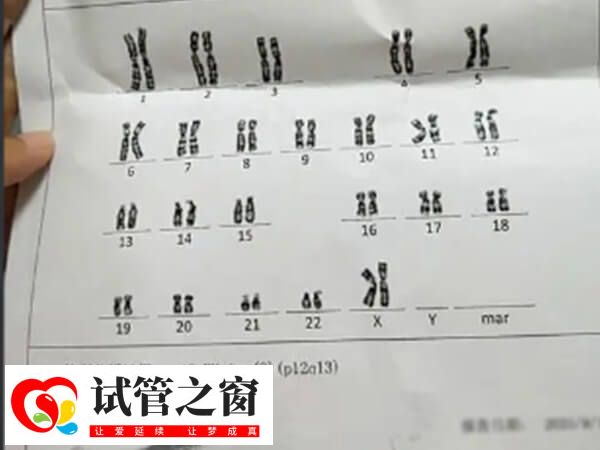 染色体46XXinv9p12q13是比较常见的