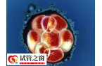 试管只有4个胚胎能不能成功