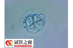 试管移植13天水印正不正常
