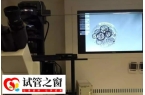 胚胎三级为什么建议养囊