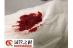 哪8大特征暗示试管失败了