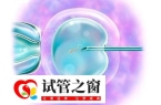 格鲁吉亚做试管的流程是怎么样的？与国内有