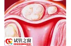子宫内膜薄能不能做试管婴儿