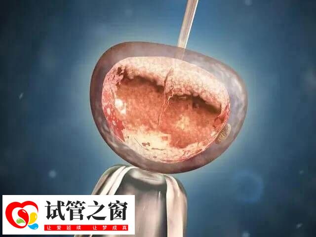 自然周期移植需满足哪些要求(图1) 自然周期移植指在自然状态下移植