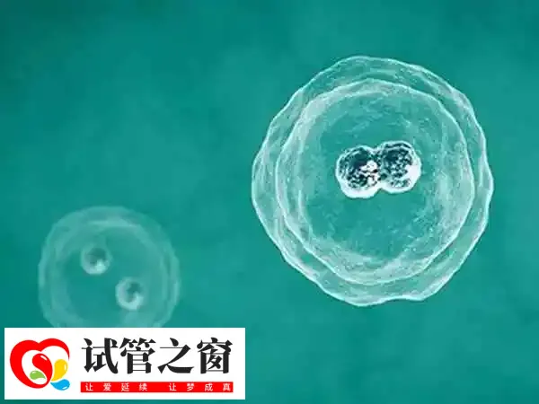 做试管精子的质量是比较重要的